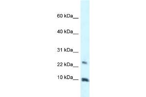 WB Suggested Anti-HMGN3 Antibody Titration: 1. (HMGN3 antibody  (Middle Region))