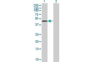 Western Blot analysis of C10orf88 expression in transfected 293T cell line by C10orf88 MaxPab polyclonal antibody. (C10orf88 antibody  (AA 1-445))