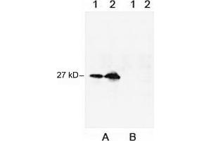 Loading: 1. (Myc Tag antibody)