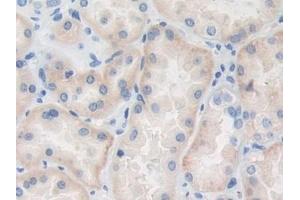 #VALUE! (TRAF4 antibody  (AA 193-444))