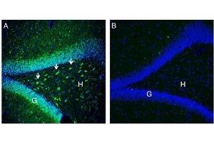 Expression of NrCAM in rat hippocampus. (NrCAM antibody  (Extracellular, N-Term))