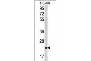 KLRC2 antibody  (N-Term)