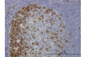 Image no. 1 for anti-Transforming, Acidic Coiled-Coil Containing Protein 3 (TACC3) (AA 1-101) antibody (ABIN6745991) (TACC3 antibody  (AA 1-101))