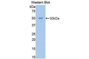 Detection of Recombinant NSE, Human using Polyclonal Antibody to Enolase, Neuron Specific (NSE) (ENO2/NSE antibody  (AA 1-434))