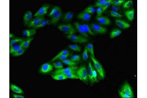 Immunofluorescent analysis of HepG2 cells using ABIN7153335 at dilution of 1:100 and Alexa Fluor 488-congugated AffiniPure Goat Anti-Rabbit IgG(H+L) (GPR183 antibody  (AA 1-31))