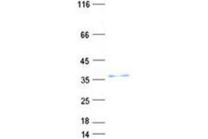 Validation with Western Blot