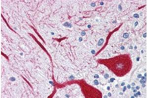 Human Brain, Cerebellum (formalin-fixed, paraffin-embedded) stained with ITPR1 antibody ABIN337359 at 5 ug/ml followed by biotinylated goat anti-rabbit IgG secondary antibody ABIN481713, alkaline phosphatase-streptavidin and chromogen. (ITPR1 antibody  (AA 1892-1911))