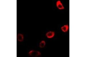 Immunofluorescent analysis of Neuroglobin staining in U2OS cells. (Neuroglobin antibody)