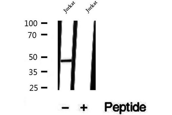 TIMM44 antibody  (N-Term)