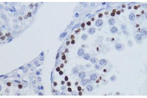 Immunohistochemistry of paraffin-embedded Rat testis using TriMethyl-Histone H3-K9 Polyclonal Antibody at dilution of 1:200 (40x lens). (Histone 3 antibody  (3meLys9))