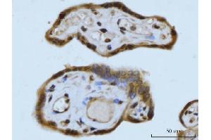 IHC analysis of SCP3/SYCP3 using anti-SCP3/SYCP3 antibody (ABIN7602415).
