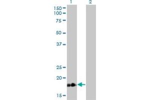 Western Blot analysis of TNNC1 expression in transfected 293T cell line by TNNC1 monoclonal antibody (M01), clone 1F8-A9. (TNNC1 antibody  (AA 1-161))