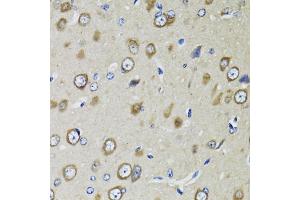Immunohistochemistry of paraffin-embedded rat brain using RPS10 antibody (ABIN5973486) at dilution of 1/100 (40x lens). (RPS10 antibody)