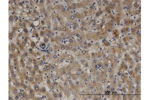 Immunoperoxidase of monoclonal antibody to PEX11B on formalin-fixed paraffin-embedded human liver. (PEX11B antibody  (AA 1-98))