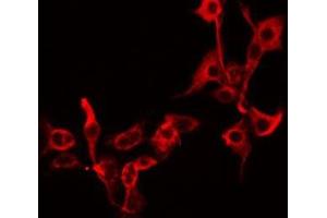 ABIN6279255 staining A549 by IF/ICC. (CPZ antibody  (Internal Region))