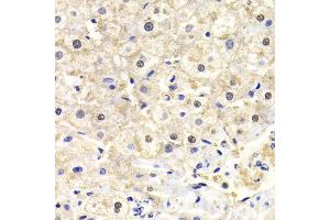 Immunohistochemistry of paraffin-embedded human liver injury using FKBP4 Antibody (ABIN5973289) at dilution of 1/200 (40x lens). (FKBP4 antibody)