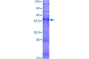 Image no. 1 for Olfactory Receptor 1M1 (OR1M1) (AA 1-313) protein (GST tag) (ABIN1313473) (OR1M1 Protein (AA 1-313) (GST tag))