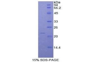 SDS-PAGE of Protein Standard from the Kit (Highly purified E. (NOS2 ELISA Kit)