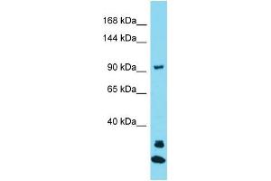 Western Blotting (WB) image for anti-Janus Kinase and Microtubule Interacting Protein 3 (JAKMIP3) (N-Term) antibody (ABIN2490478) (JAKMIP3 antibody  (N-Term))