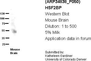 Image no. 1 for anti-Heat Shock Transcription Factor 2 Binding Protein (HSF2BP) (N-Term) antibody (ABIN2776048) (HSF2BP antibody  (N-Term))