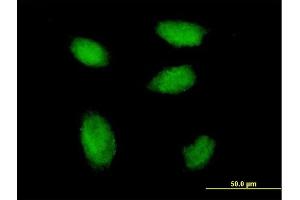 Immunofluorescence of monoclonal antibody to RSF1 on HeLa cell. (RSF1 antibody  (AA 1343-1441))