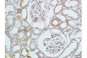 Formalin-fixed and paraffin embedded rat kidney labeled with Anti-HB EGF Polyclonal Antibody, Unconjugated (ABIN701050) at 1:200 followed by conjugation to the secondary antibody and DAB staining (HBEGF antibody  (AA 51-150))