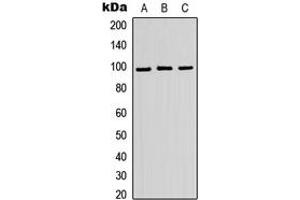 Western blot analysis of ATP6V0A2 expression in HEK293T (A), Raw264.