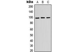 Western blot analysis of ATP6V0A2 expression in HEK293T (A), Raw264. (ATP6V0A2 antibody  (Center))