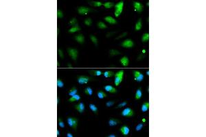 Immunofluorescence analysis of HeLa cell using F11R antibody. (F11R antibody  (AA 30-238))
