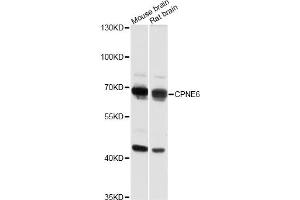 Western blot analysis of extracts of various cell lines, using CPNE6 antibody (ABIN6291377) at 1:3000 dilution. (CPNE6 antibody)