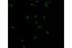 Immunofluorescence staining of MCF7 Cells with ABIN7127575 at 1:50, counter-stained with DAPI. (Recombinant Insulin Receptor antibody)
