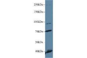 Western Blotting (WB) image for anti-Fibroblast Growth Factor Receptor 2 (FGFR2) (AA 157-377) antibody (ABIN1858879)