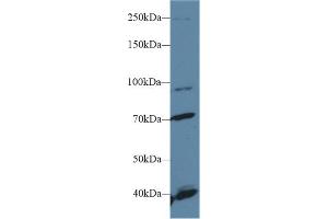 Western Blot; Sample: Human Hela cell lysate; Primary Ab: 1µg/ml Rabbit Anti-Human FGFR2 Antibody Second Ab: 0.