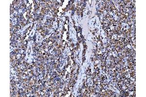 IHC analysis of Aconitase 2 using anti-Aconitase 2 antibody (ABIN7602770). (ACO2 antibody  (C-Term))