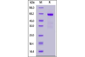 Human ASGR1, Fc Tag on  under reducing (R) condition. (Asialoglycoprotein Receptor 1 Protein (ASGR1) (AA 62-291) (Fc Tag))