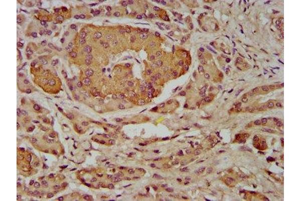 INPP5B antibody  (AA 78-178)