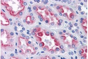 Human Kidney: Formalin-Fixed, Paraffin-Embedded (FFPE) (AKR1B10 antibody  (AA 76-144))