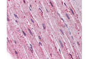 Anti-ADAMTS4 antibody IHC of human heart. (ADAMTS4 antibody  (C-Term))