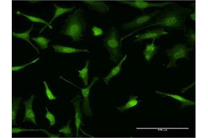 Immunofluorescence of monoclonal antibody to PURA on HeLa cell. (PURA antibody  (AA 183-292))