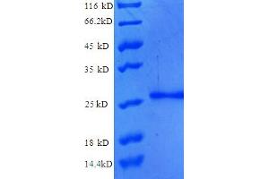 SDS-PAGE (SDS) image for Nucleoporin 210kDa (NUP210) (AA 28-238), (partial) protein (His tag) (ABIN5710035)