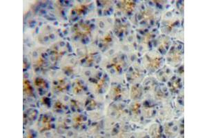 IHC-P analysis of adrenal tissue, with DAB staining. (IGFBP3 antibody  (AA 137-274))
