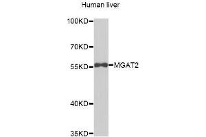 Western blot analysis of extracts of Human liver cells, using MGAT2 antibody. (MGAT2 antibody)