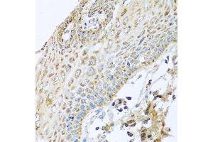 Immunohistochemistry of paraffin-embedded human esophagus using NDUFA2 antibody at dilution of 1:100 (x40 lens). (NDUFA2 antibody)