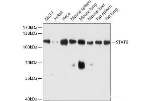 Western blot analysis of extracts of various cell lines using STAT6 Polyclonal Antibody at dilution of 1:1000. (STAT6 antibody)