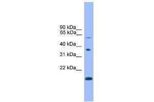 WB Suggested Anti-NOTCH4 Antibody Titration:  0. (NOTCH4 antibody  (C-Term))