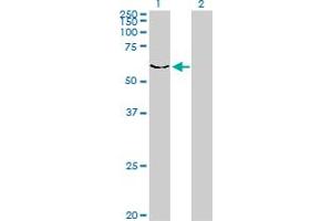 Western Blot analysis of DYRK2 expression in transfected 293T cell line by DYRK2 monoclonal antibody (M01), clone 3G5. (DYRK2 antibody  (AA 1-100))