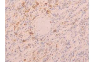 DAB staining on IHC-P; Samples: Human Spleen Tissue (TLR5 antibody  (AA 693-858))