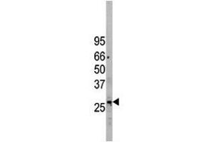 Image no. 1 for anti-Eukaryotic Translation Initiation Factor 2B, Subunit 3 Gamma, 58kDa (EIF2B3) (C-Term) antibody (ABIN357251) (EIF2B3 antibody  (C-Term))