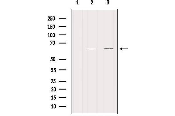 KRT9 antibody  (Internal Region)