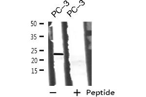 Western blot analysis of BOK using PC-3 whole cell lysates (BOK antibody  (N-Term))